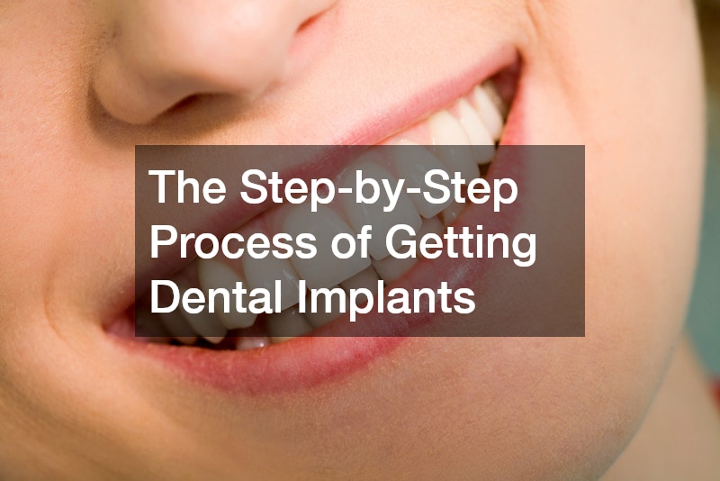 The Step-by-Step Process of Getting Dental Implants